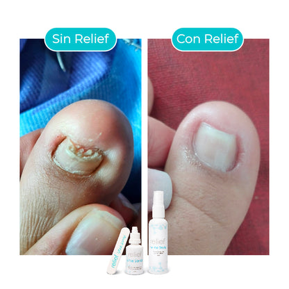 Gotas para hongos en las uñas